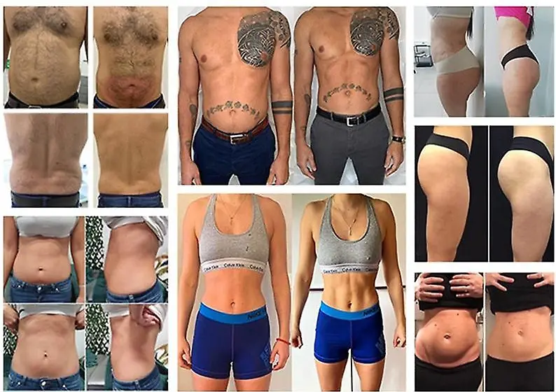 ems neo,ems,fitness,ems lalouviere,ems belgique,emsculpt belgique,musculation,maigrir,minceur,abdominaux,institut de beauté,zay beauty, la louvière,radiofréquence,coussin pelvien,renforcement musculaire,gymnastique passive,maigrir sans effort,maigrir sans regime,muscles,abs,six pack