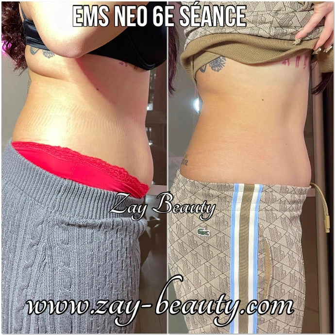 ems,ems neo,emsculpt neo la louviere,emslim la louviere,hainaut,belgique, maigrir sans effort,gym passive